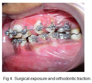 Balaji Orthodontics Pdf Free 2020 Download fig-48