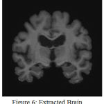 Figure 6: Extracted Brain