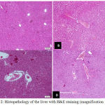 Figure 2: Histopathology of the liver with H&E staining (magnification 100 x).