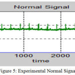 Figure 5: Experimental Normal Signal