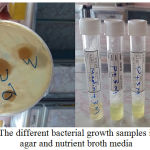 Figure 1: The different bacterial growth samples in nutrient agar and nutrient broth media