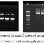 Figure 1: Agarose gel electrophoresis for amplification of second, third and four exon GH1 gene of control and acromegaly patients