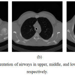 Figure 3: The segmentation of airways in upper, middle, and lower slices in a CT scan respectively.