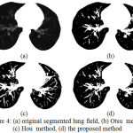 Figure 4: (a) original segmented lung field, (b) Otsu method, (c) Hou method, (d) the proposed method