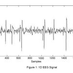 Figure 1: 1D EEG Signal