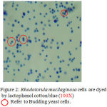 Figure 2: Rhodotorula mucilaginosa cells are dyed by lactophenol cotton blue (100X) Ο Refer to Budding yeast cells.