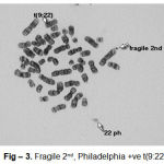 Figure 3: Fragile 2nd, Philadelphia +ve t(9:22)