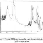 Figure 7: Typical FTIR spectrum of a central part cholesterol of gallstone samples.