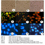 Figure 1: Microscopic views of MCF - 7 cell lines treated with Lamprachaenium microphalum.
