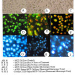 Figure 2: Microscopic views of MCF - 7 cell lines treated with Cassia alata.