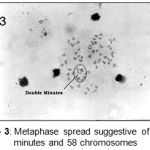 Figure 3: Metaphase spread suggestive of double minutes and 58 chromosomes.