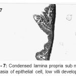 Figure 7: Condensed lamina propria sub mucosal, dysphasia of epithelial cell, low villi development.