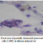 Figure 3: Focal area of partially destructed pancreatic cells (´ 400) in alloxan induced rat