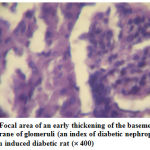 Figure 6: Focal area of an early thickening of the basement membrane of glomeruli (an index of diabetic nephropathy) in alloxan induced diabetic rat (´ 400)