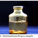 Figure 1: Endometrium Biopsy sample
