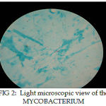 Figure 2: Light Microscopic View Of The Mycobacterium