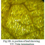 Figure 3B: A portion of leaf showing the Vein-islet and termination