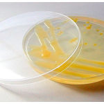 Figure 5: Staphylococcus aureus.