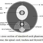 Figure 4: The cross section of simulated neck phantom including cervical vertebrae, the spinal cord, trachea and thyroid heterogeneities
