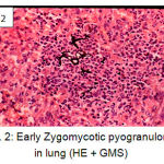 Figure 2: Early Zygomycotic pyogranuloma in lung (HE + GMS)