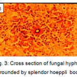Figure 3: Cross section of fungal hyphae surrounded by splendor hoeppli bodies
