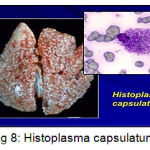 Figure 8: Histoplasma capsulatum