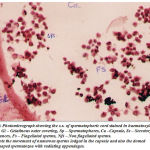 Figure 10: Photomicrograph showing the c.s. of spermatophoric cord stained in haematoxylin and eosin. Gl – Gelatinous outer covering, Sp – Spermatophores, Ca –Capsule, Ss – Secretory Substances, Fs – Flagellated sperms, Nfs – Non flagellated sperms.Note the movement of numerous sperms lodged in the capsule and also the domedshaped spermatozoa with radiating appendages.