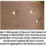 Figure 4: Micrograph of ileum of rats treated with 10mg/kg of diesel [H&E x10] showing severe degeneration of mucosal vili (A), without involving the Brunner’s glands (B) and a normal lymphoid aggregate in the lamina propria (C).