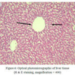 Figure 6: Optical photomicrographic of liver tissue (H & E staining, magnification × 400)