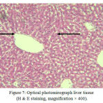 Figure 7: Optical photomirograph liver tissue (H & E staining, magnification × 400).