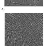 Figure 1: Representative myoblasts and myotubes derived from Wistar rat skeletal muscle.A) myoblasts taken during the third week of tissue culture and B) myotubes taken during sixth week of tissue culture.
