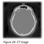 Figure 26: CT image