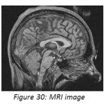 Figure 30: MRI image