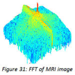 Figure 31: FFT of MRI image
