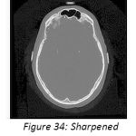 Figure 34: Sharpened image by BHPF