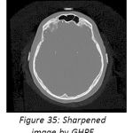 Figure 35: Sharpened image by GHPF