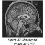 Figure 37: Sharpened image by GHPF