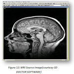 Figure 12: MRI Source Image(courtesy-3D DOCTOR SOFTWARE)