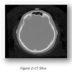 Figure 2: CT Slice