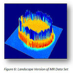 Figure 6: Landscape Version of MR Data Set