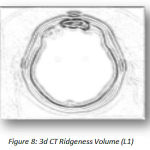 Figure 8: 3d CT Ridgeness Volume (L1)