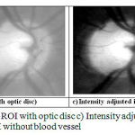 Figure 2: a) Input image b) ROI with optic disc c) Intensity adjusted image d) ROI without blood vessel