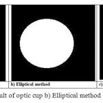 Figure 4: Images of a) Result of optic cup b) Elliptical method c) Morphological method