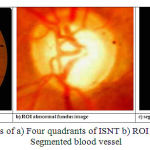 Figure 6: Images of a) Four quadrants of ISNT b) ROI of abnormal c) Segmented blood vessel