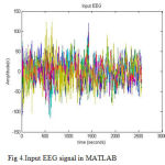 Figure 4: Input EEG signal in MATLAB