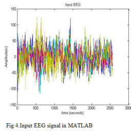 Denoising of EEG signals using Discrete Wavelet Transform Based Scalar ...