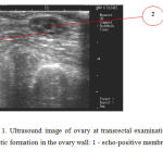 Figure 1. Ultrasound image of ovary at transrectal examination of cow’s genitals. Cystic formation in the ovary wall: 1 - echo-positive membrane; 2 - cyst camera.