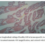 Figure 1: the longitudinal cutting of healthy Gill in lacuna space(b), in (a) we have hemocytes in natural amounts. 400 magnification, and colored with hematoxylin eosin.