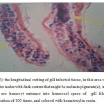 Figure (2): the longitudinal cutting of gill infected tissue, in this area we can see hemocytes nodes with dark centers that might be melanin pigments(a), in this area we can see hemocyt entrance into hemocoel space of gill filaments(b), magnification of 100 times, and colored with hematoxylin eosin.
