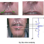 Fig 2.lip colour analyzing